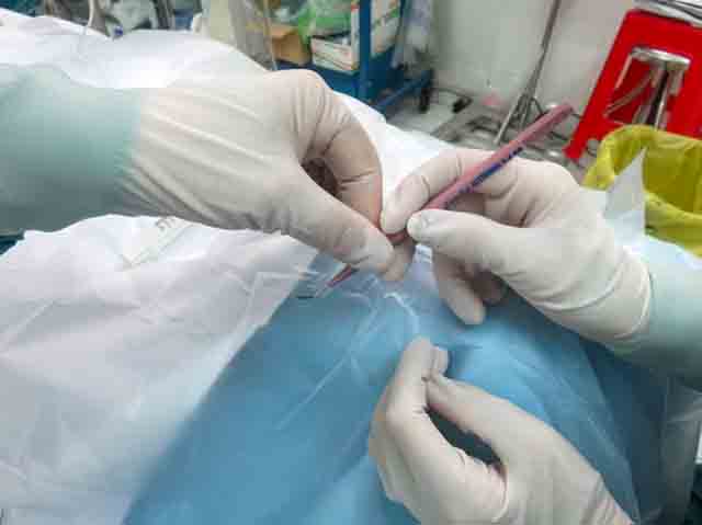 Figure 1: Passing a keratome blade to the surgeon with the sharp end facing away from them.(Photo: Jacqueline Newton CC BY-NC-SA 4.0)