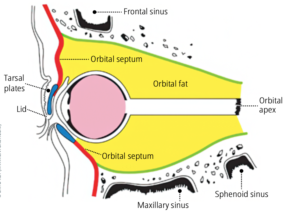 PHFI CEHJ » Preseptal and orbital cellulitis: how to identify and treat ...