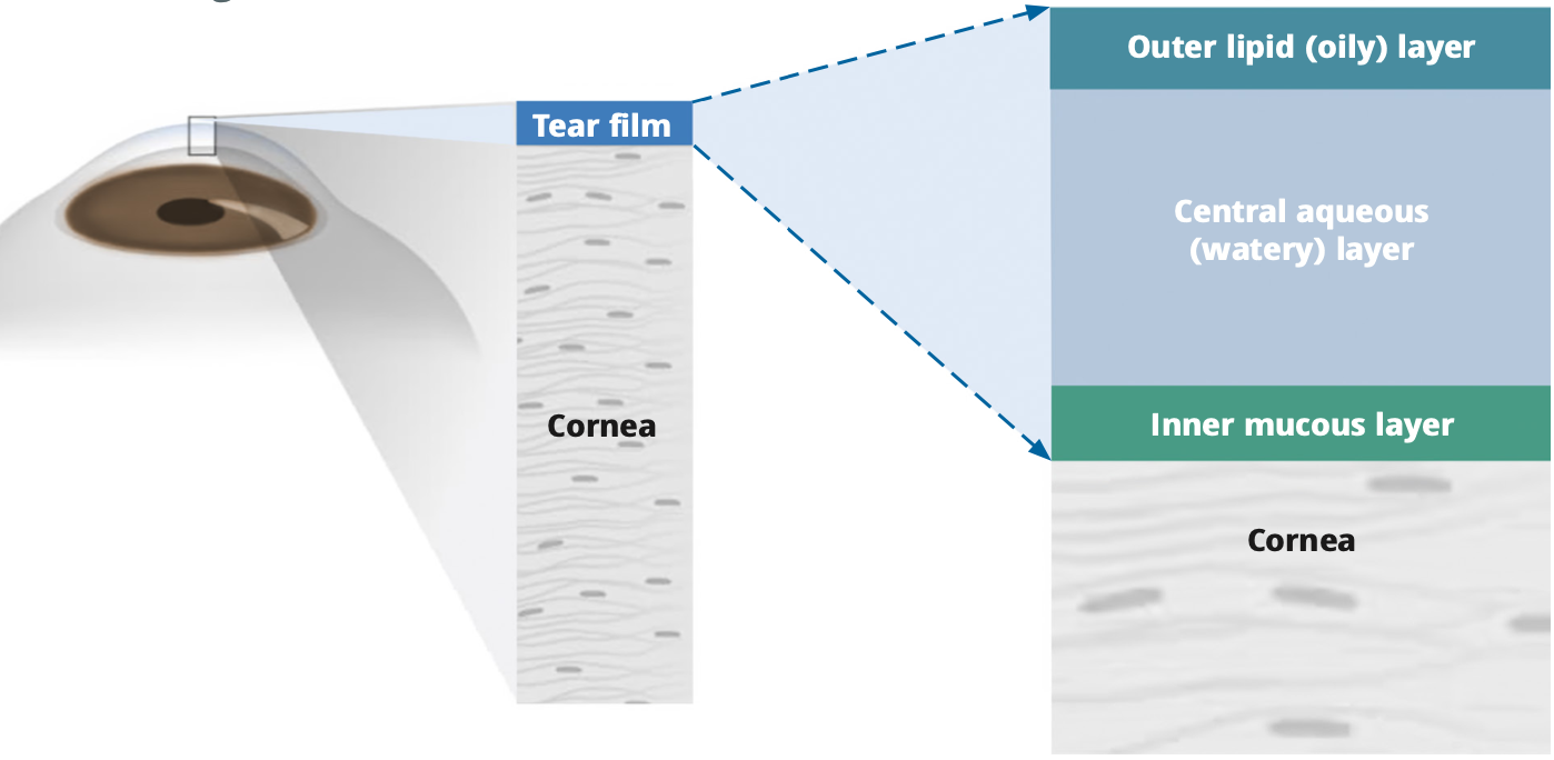 Figure 1 The position and composition of the tear film. (Photo: © ICEH CC BY-NC-SA 4.0)